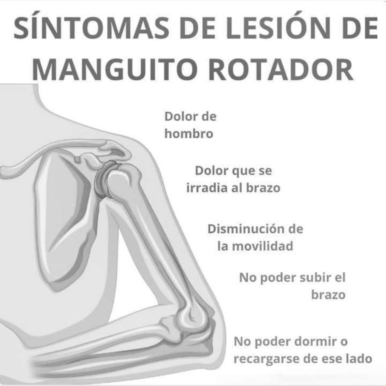 Síndrome doloroso de hombro