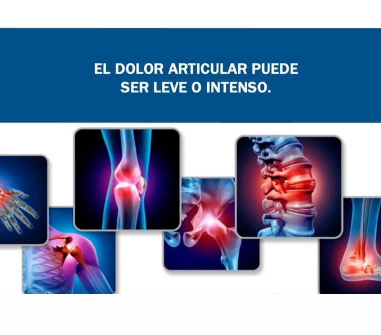 Dolor de cuello