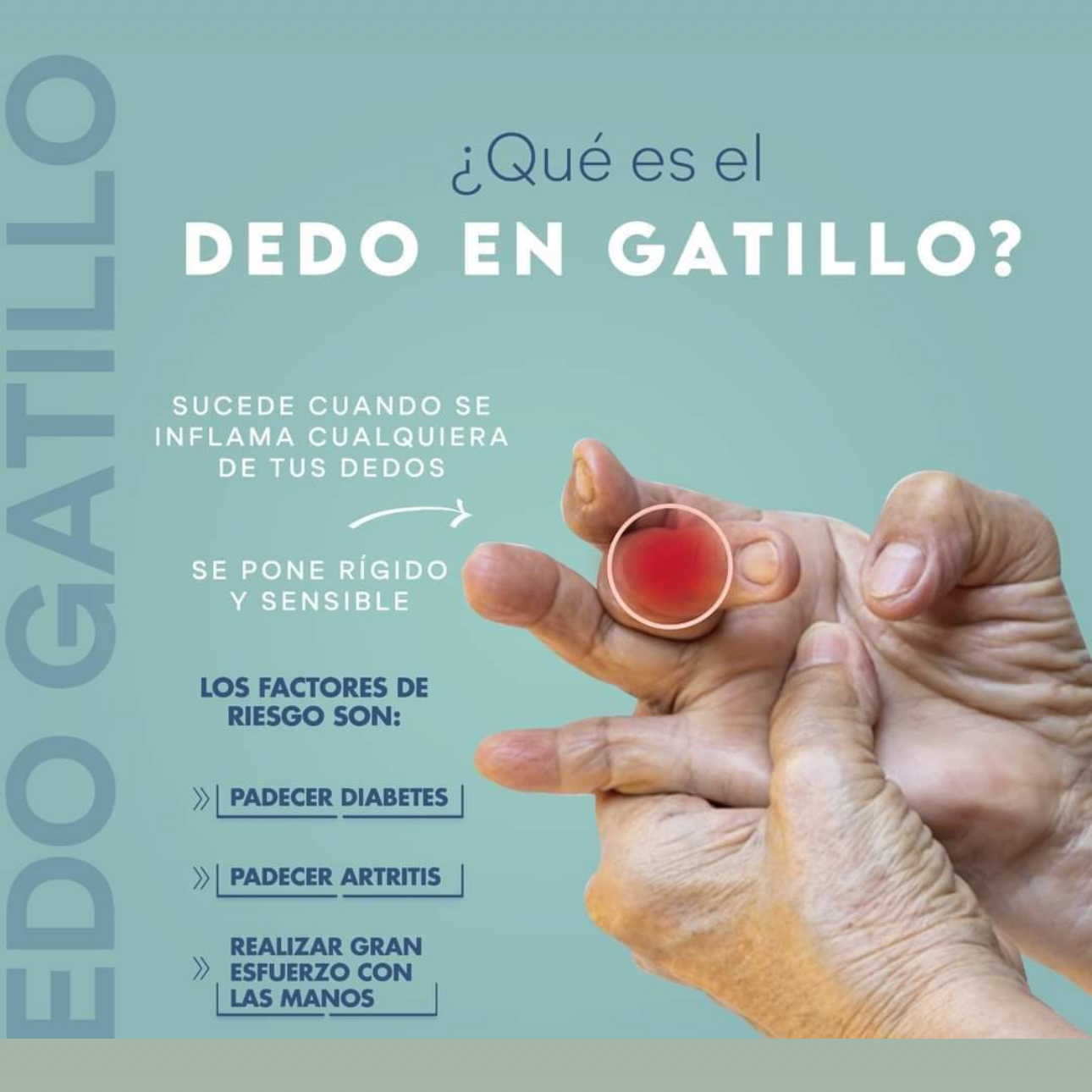 Dedo en gatillo